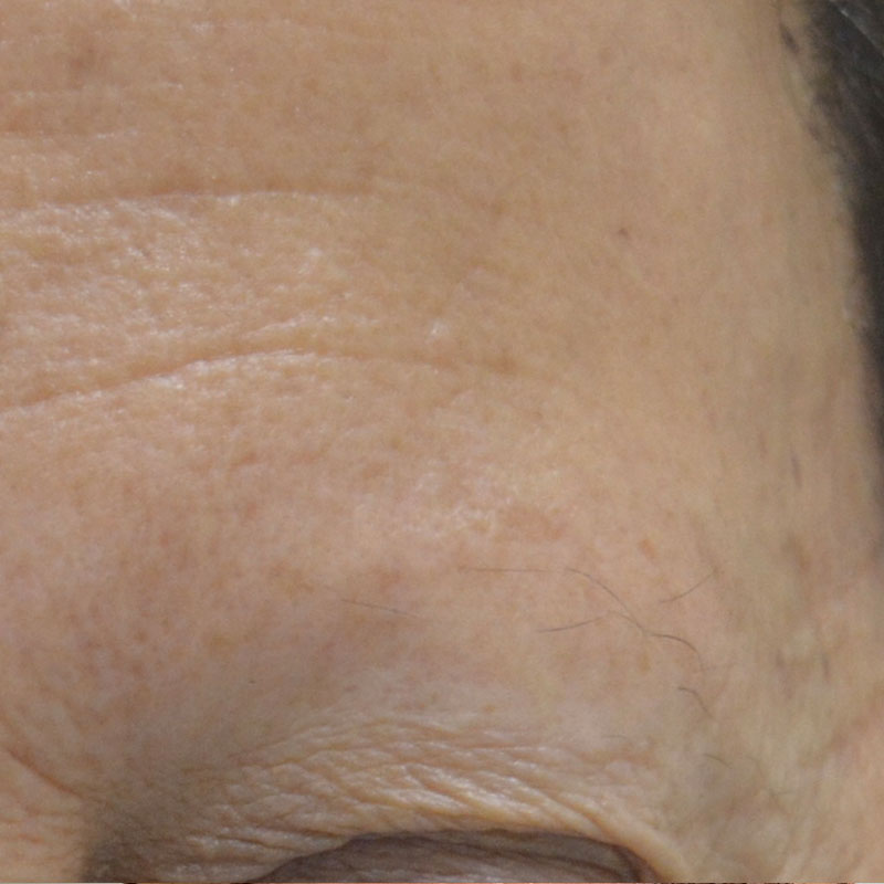 Imagen antes (Caso facial 1)