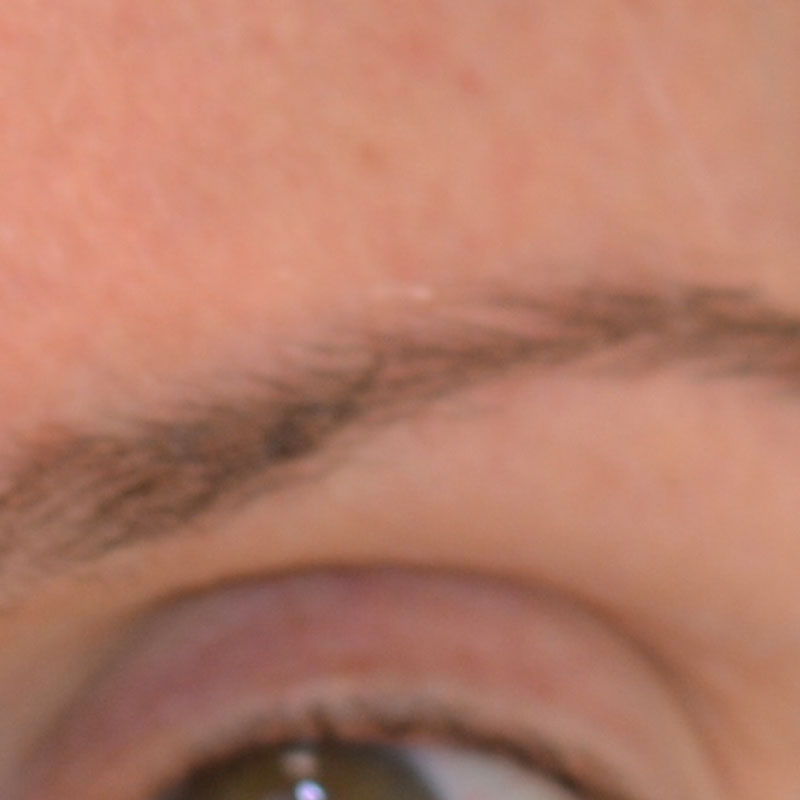 Imagen antes (Caso facial 3)