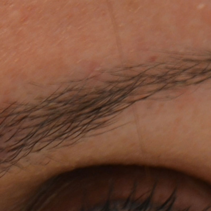 Imagen después (Caso facial 3)